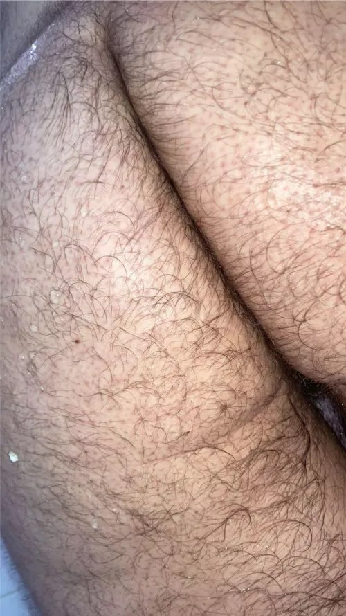 Don’t you just love a nice hairy ass? 🤤