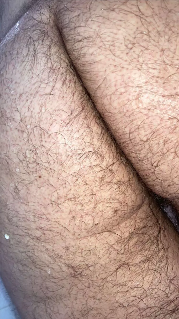 Don’t you just love a nice hairy ass? 🤤