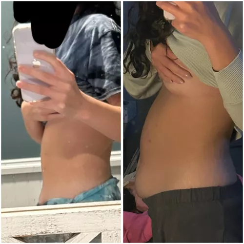 F20. Should i worry about this bloating or can i ignore it