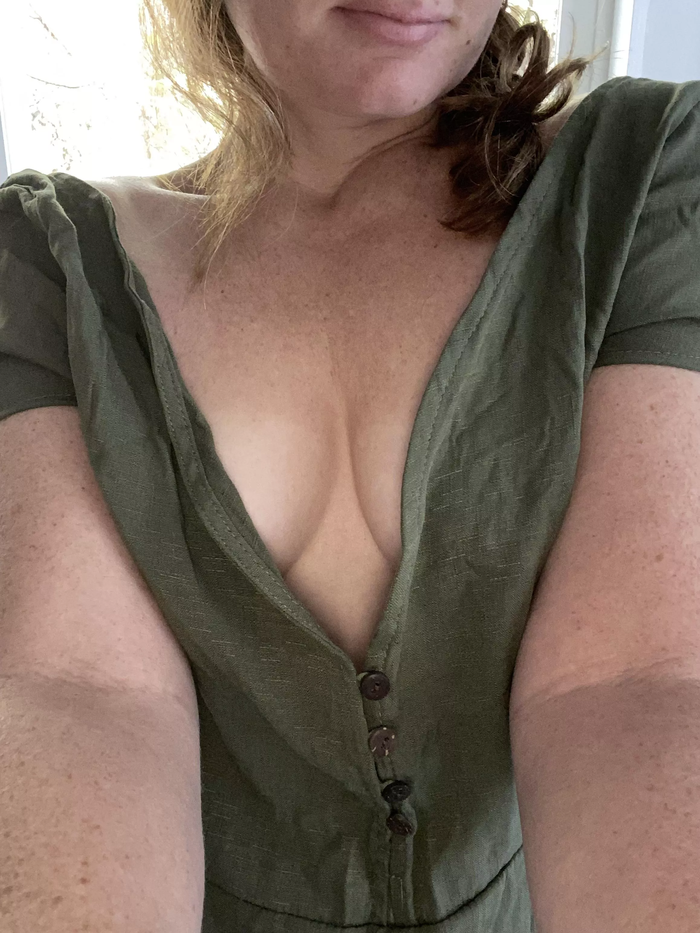 I’m glad I found a place that loves freckles 