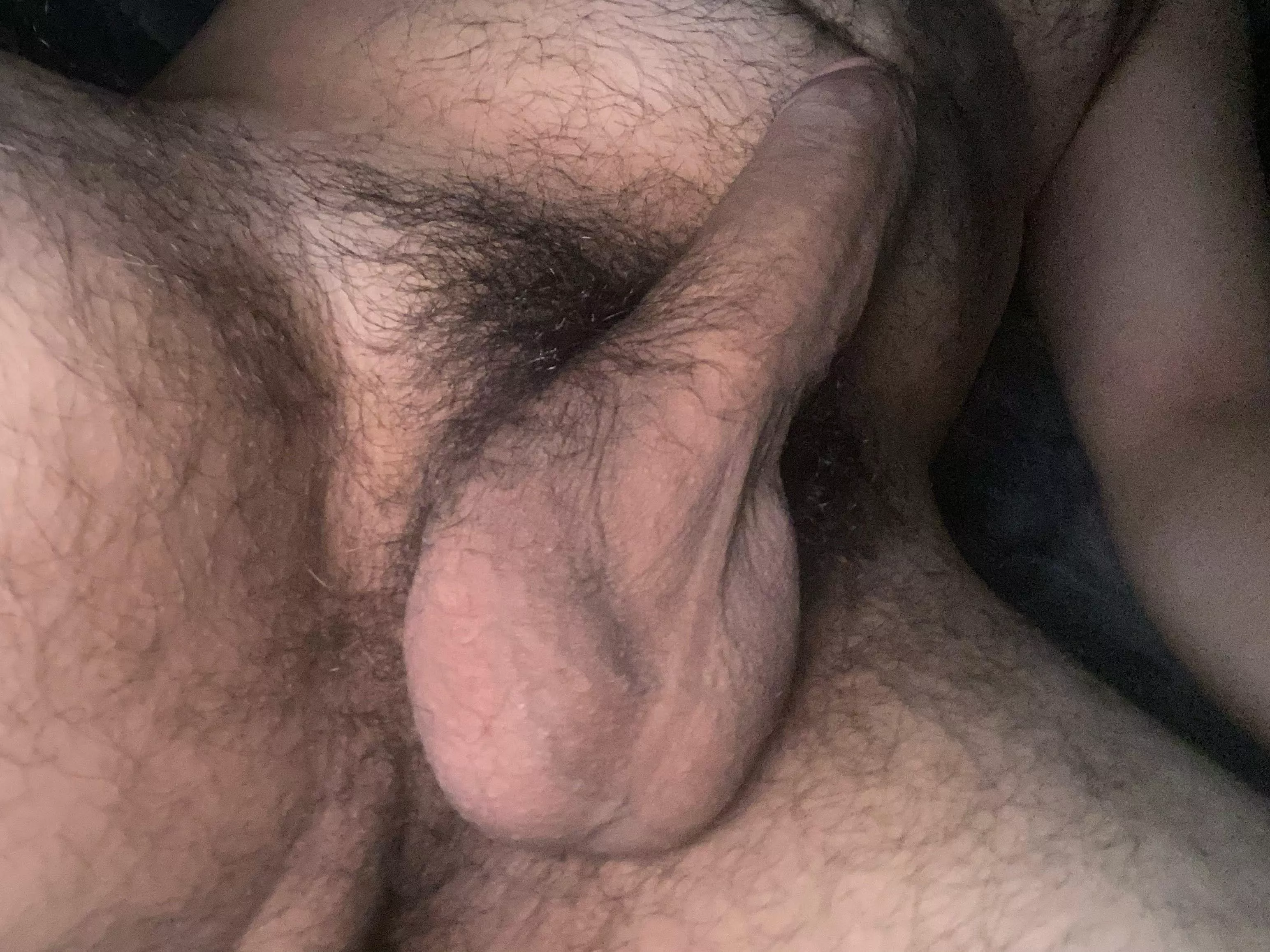 Nothing to see here. Normal 