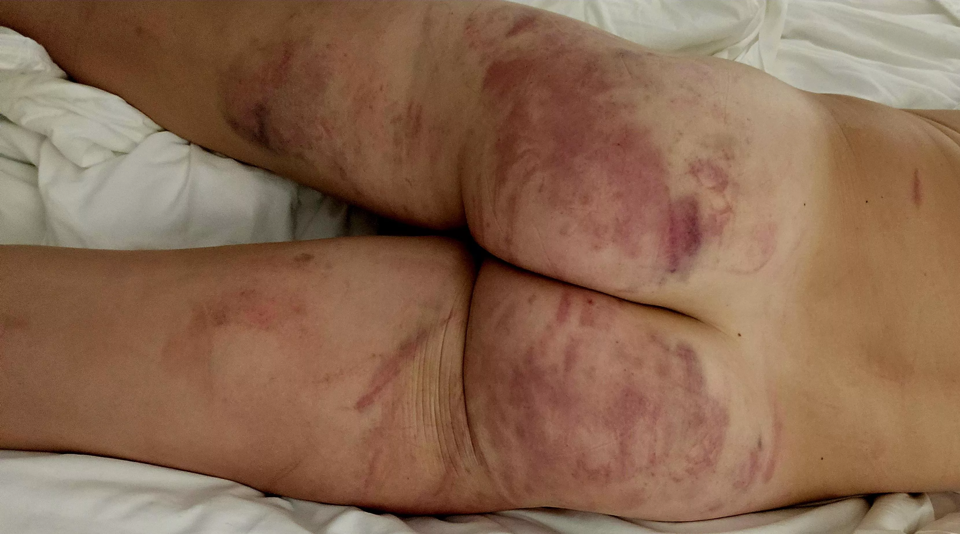 She beat me up good 🥰