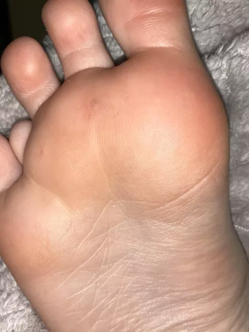 wtf are these on my foot? Is this a virus