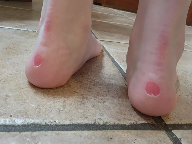 Breaking in new docs be like