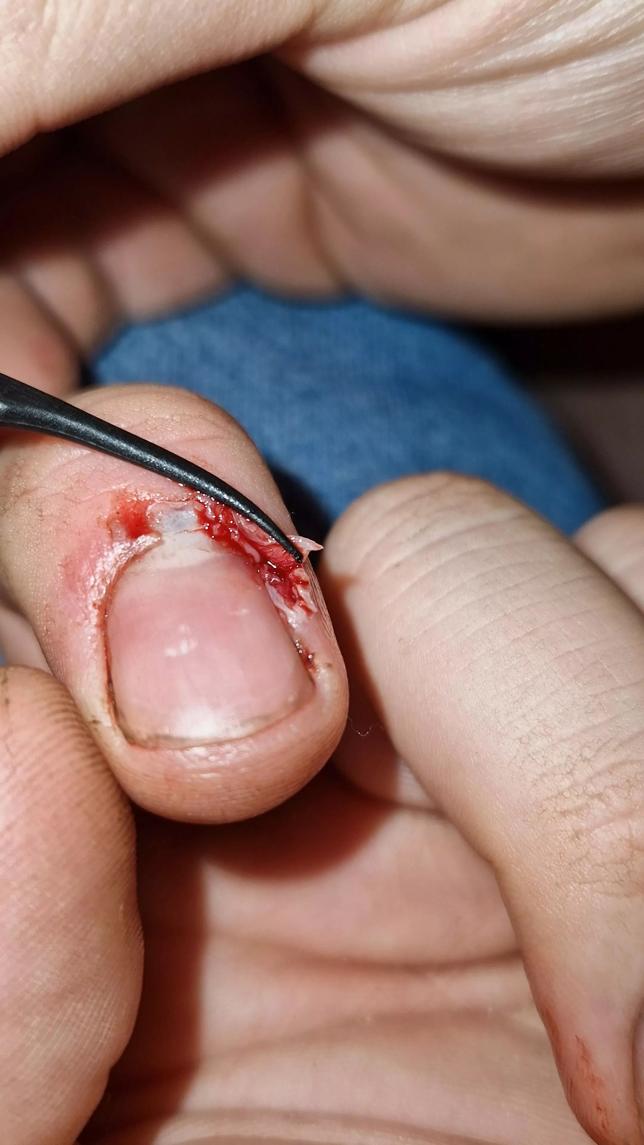 Drilled into my finger