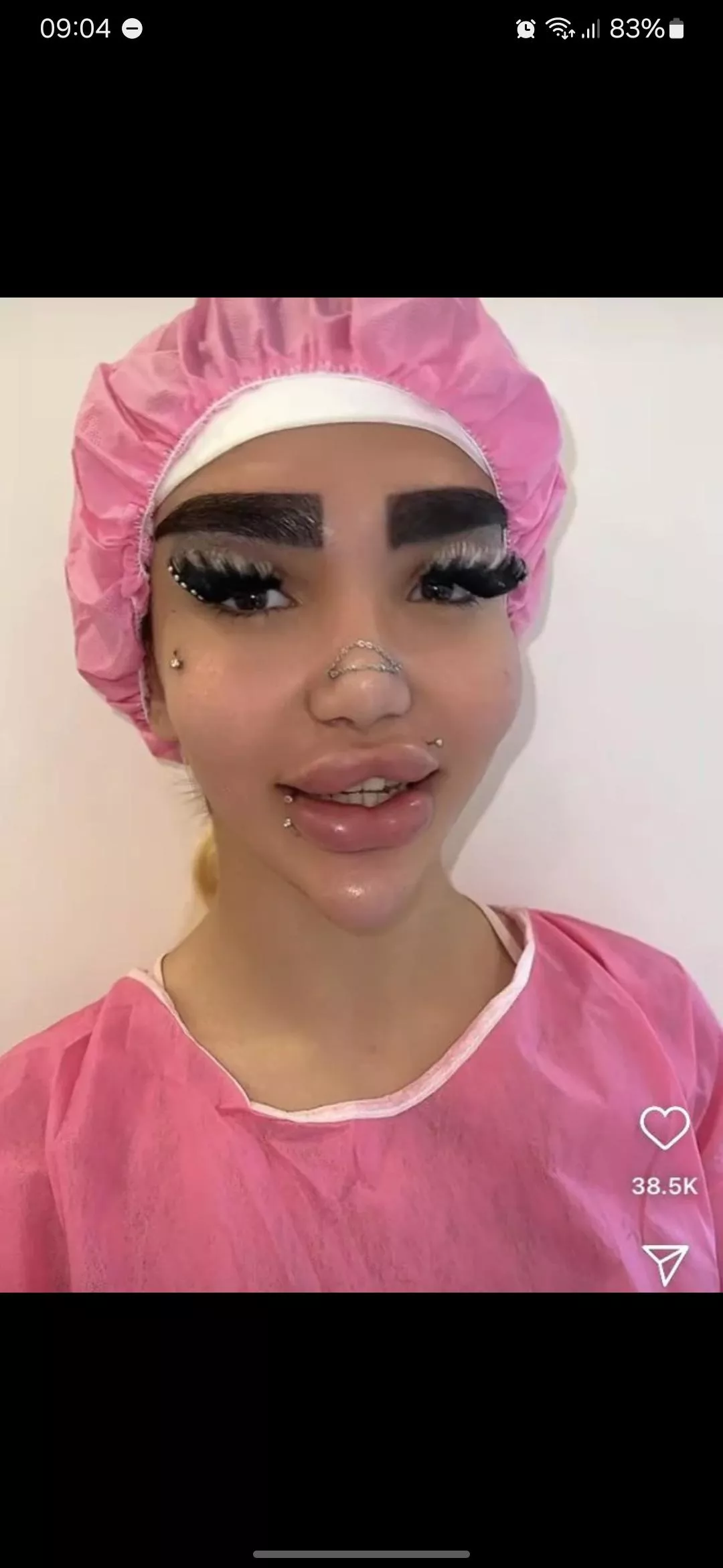 Her lips look like they're about to explode :(