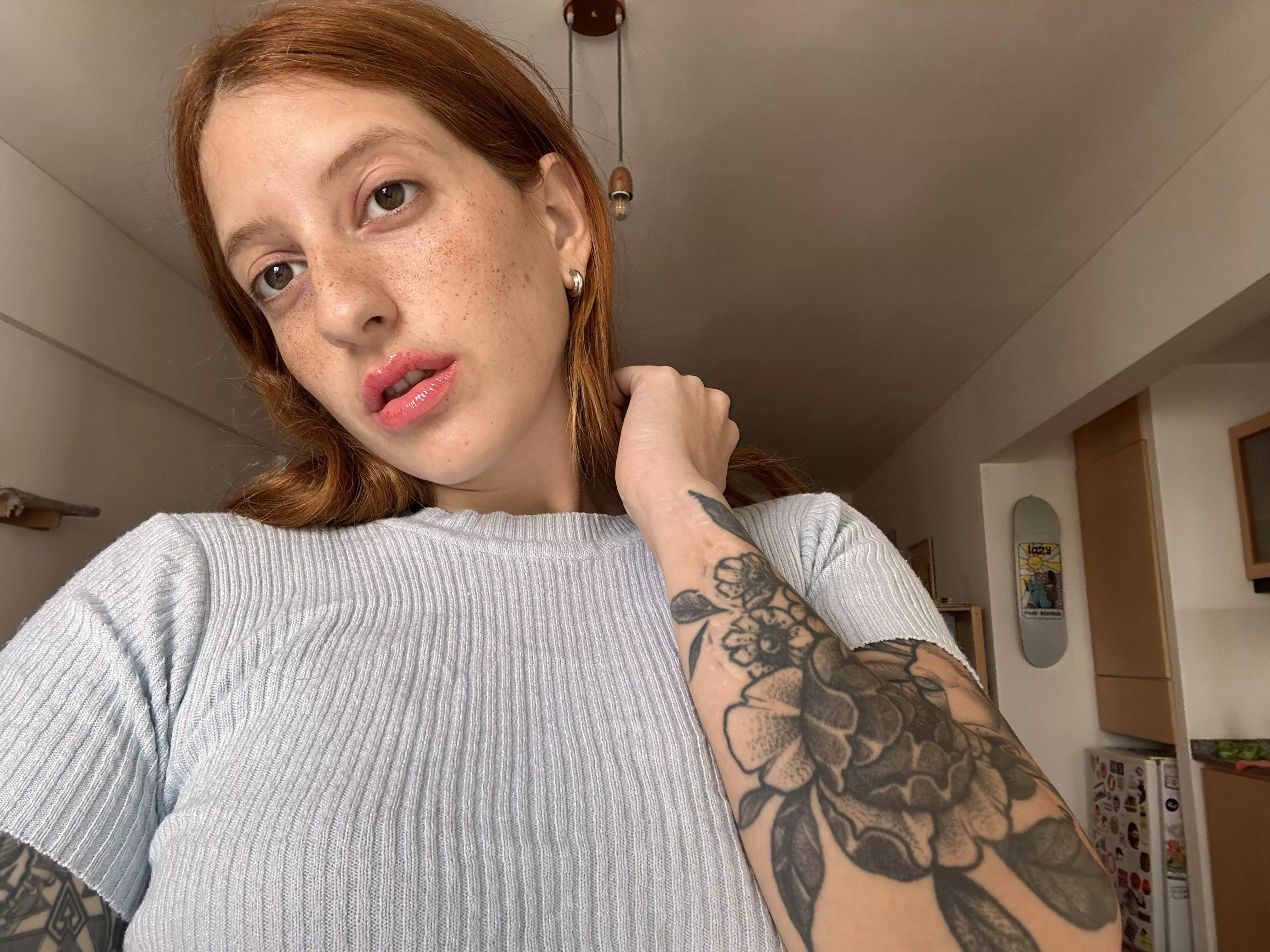 Is there such thing as too much freckles? 