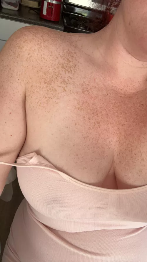 Let’s play connect the freckles 👅