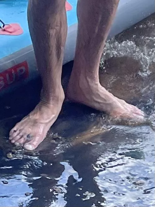 Look at these feet. So stinky I had to cover my nose. Doesn’t compare to my hardly smelly toes 🤢😷