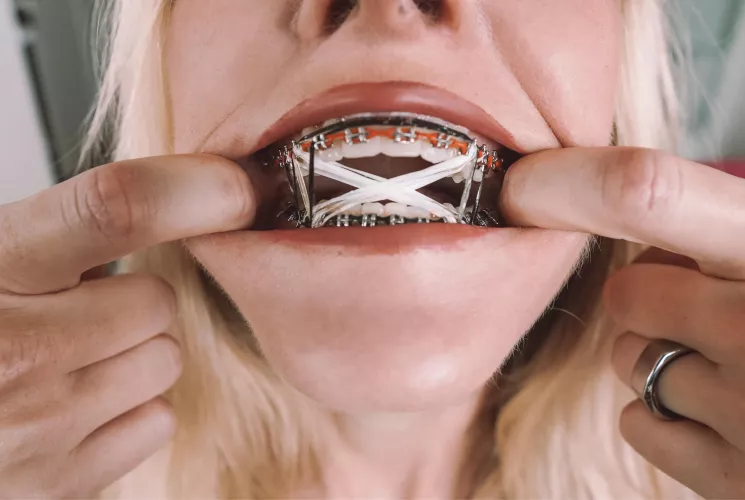 Stretching my cheeks but I can’t open my mouth any wider than this