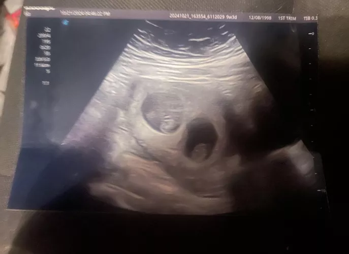 We found out there will be two.