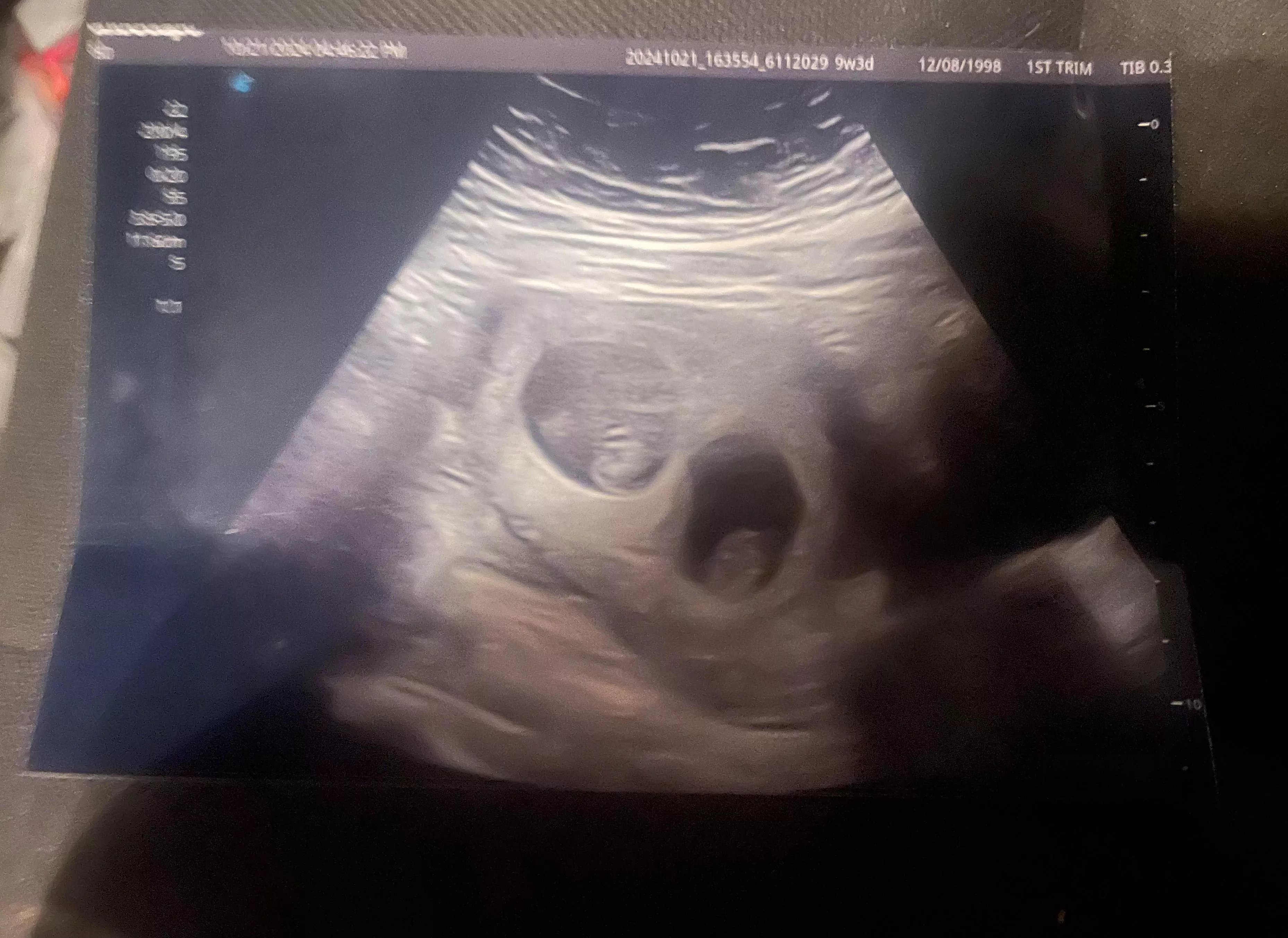 We found out there will be two.