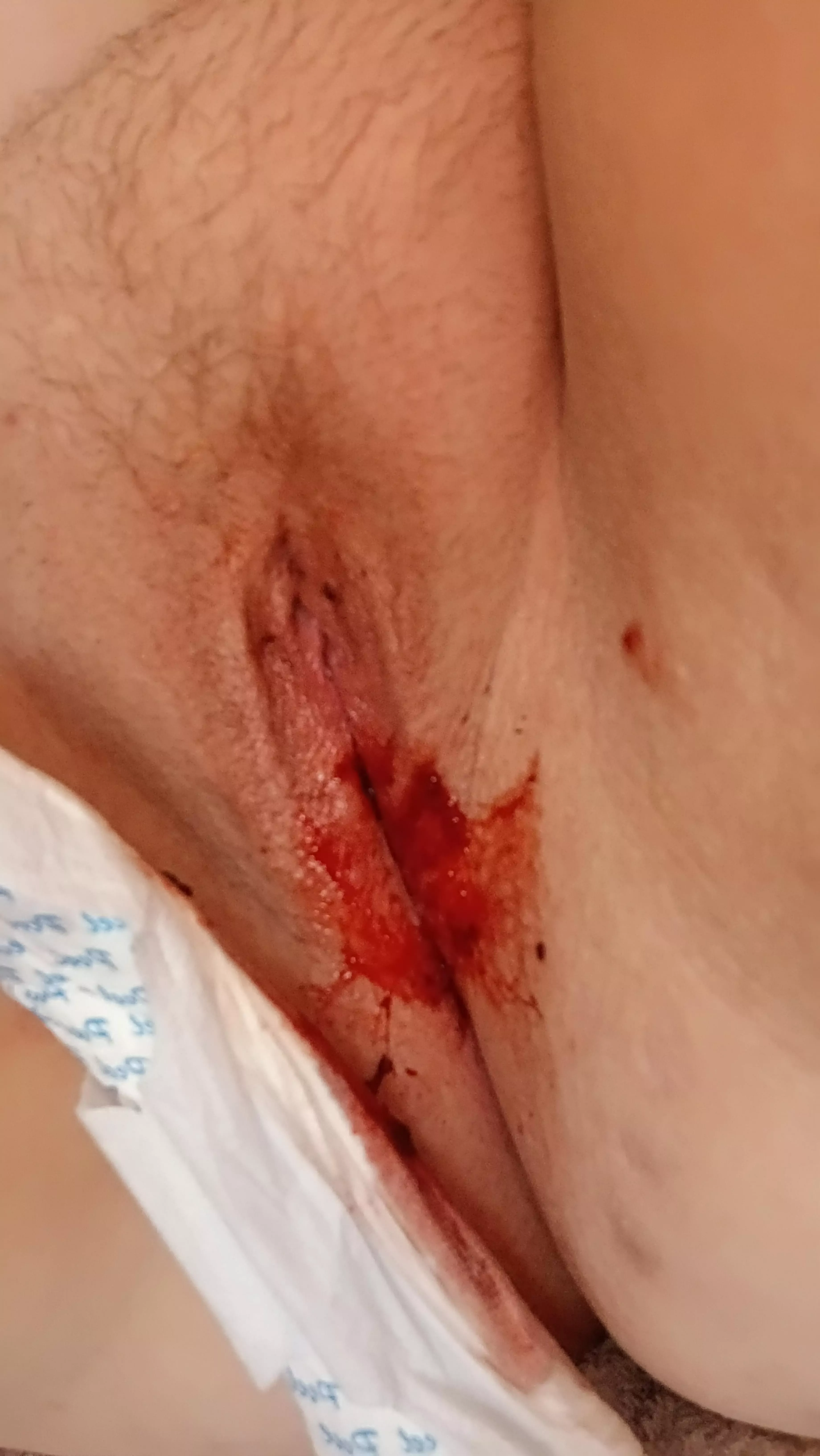 Will you clean me up?