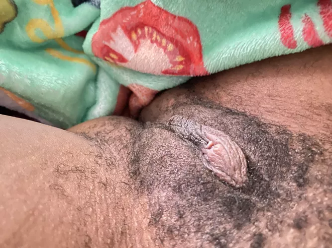 26 f  T1D , BPD, autism, Mh issues In need of head 