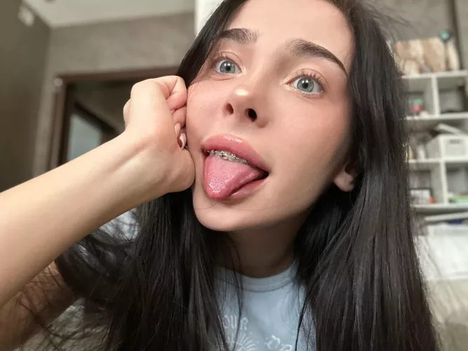 Braces make my teeth look really charming