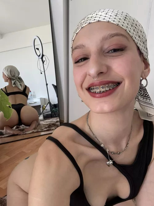 cum is missing on my braces!