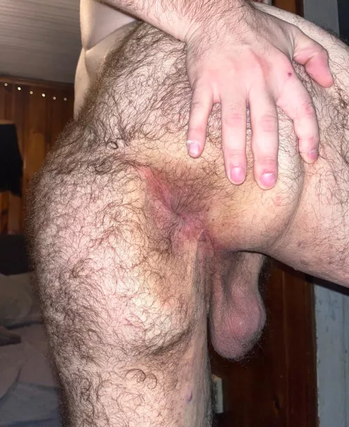 Hairy hole