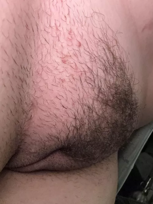 Hairy mound 
