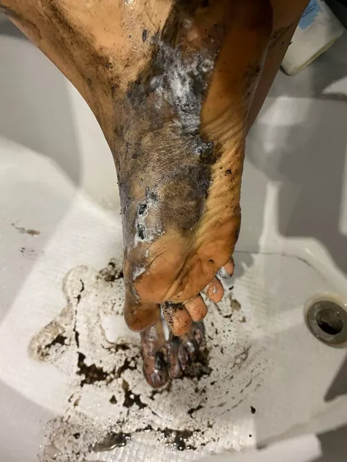Insanely dirty feet that are very difficult to clean