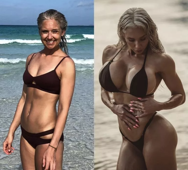 Karen Orlena before implants and at 1600cc