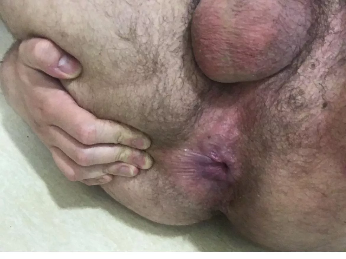 please fuck my disgusting pig hole 🐷🐷