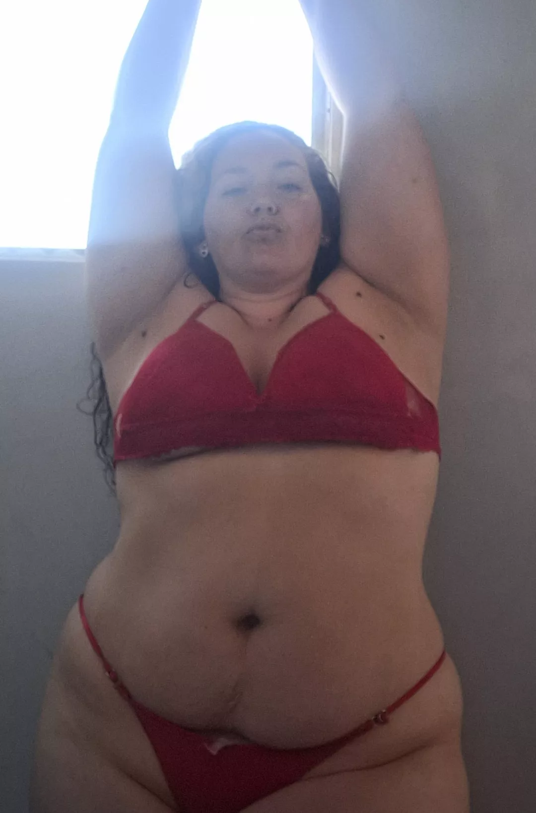 There are many moles around my armpits