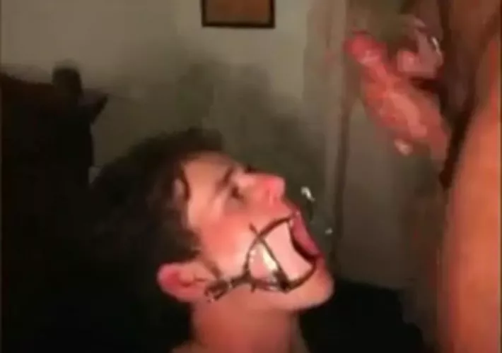 What’s the name of this “device” to spread the mouth open wide? Looking to get it but can’t find it online. 