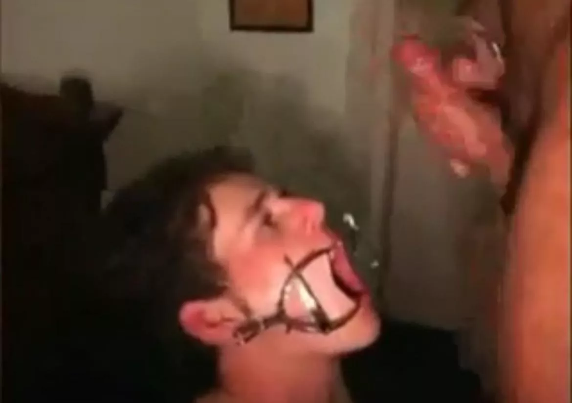 What’s the name of this “device” to spread the mouth open wide? Looking to get it but can’t find it online. 