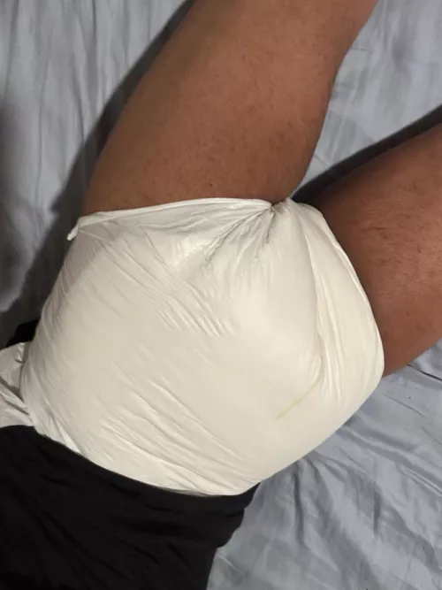 Worthy of diaper pats?