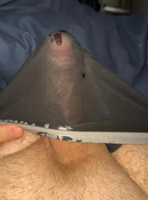 [26M Stockton] These boxers are a little bit too revealing… don’t you think? 😏