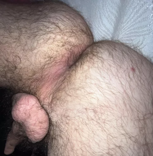 Am I to hairy?