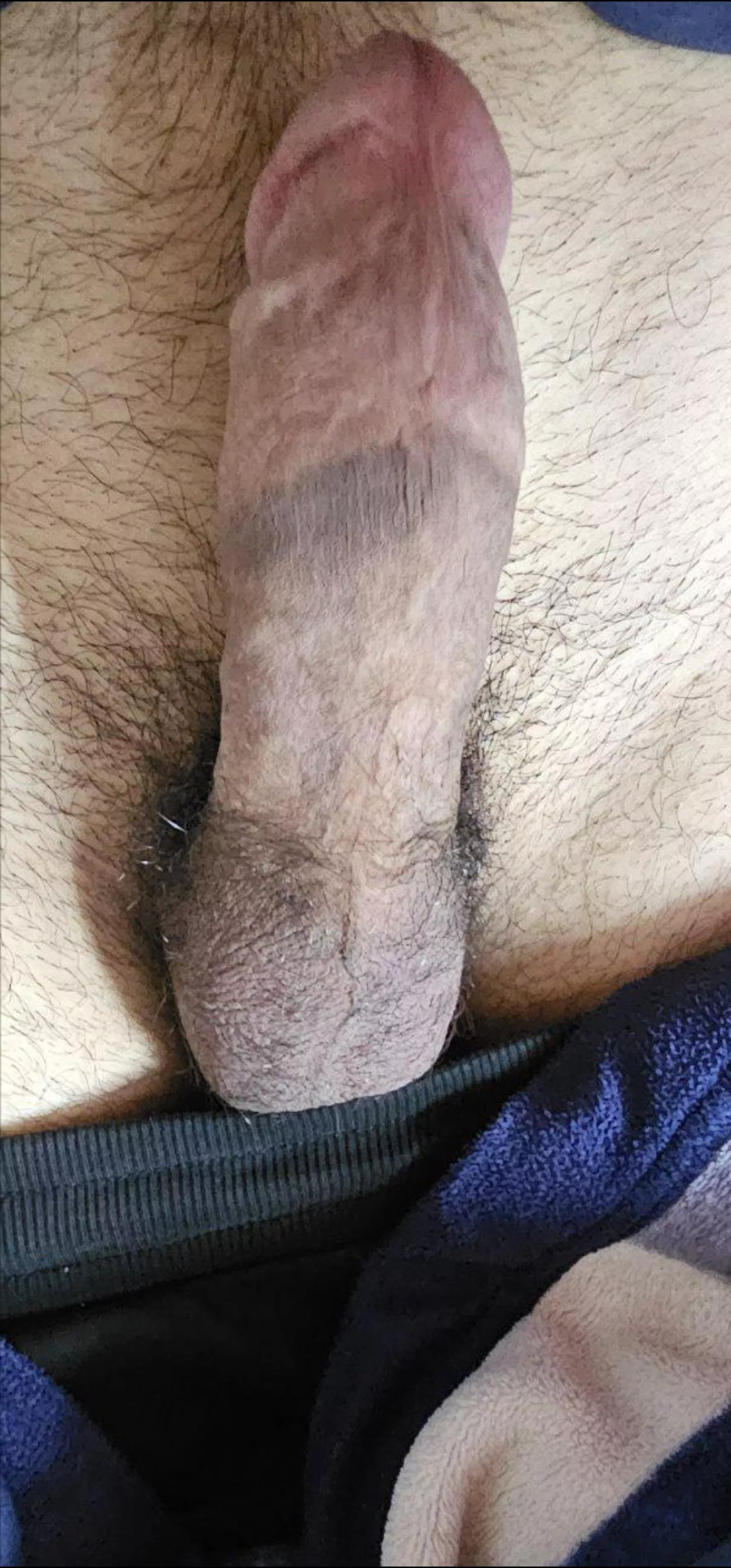 Does my circumcised penis look good ot not?