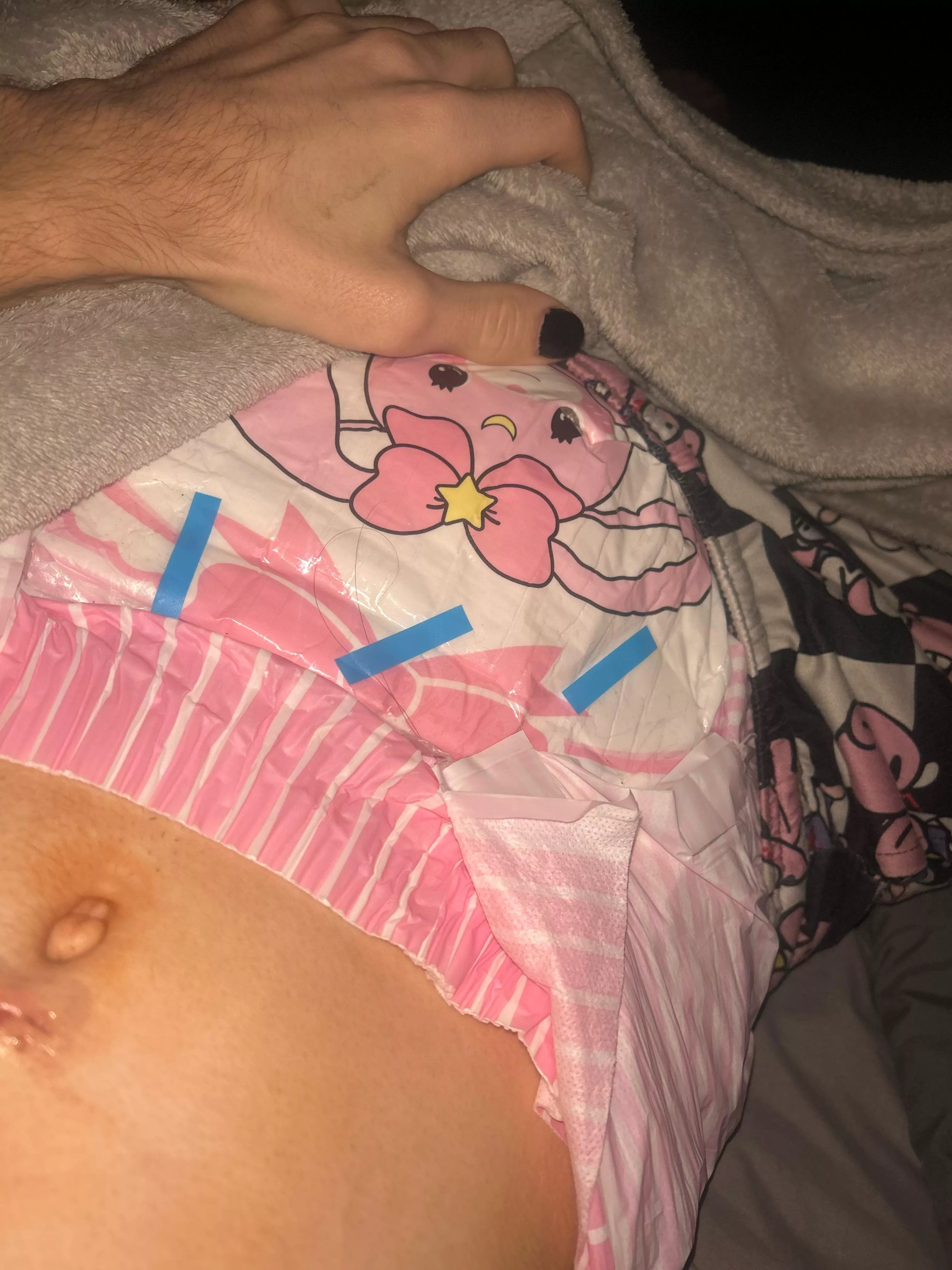 first time posting, decided to pad up since i had surgery this morning 