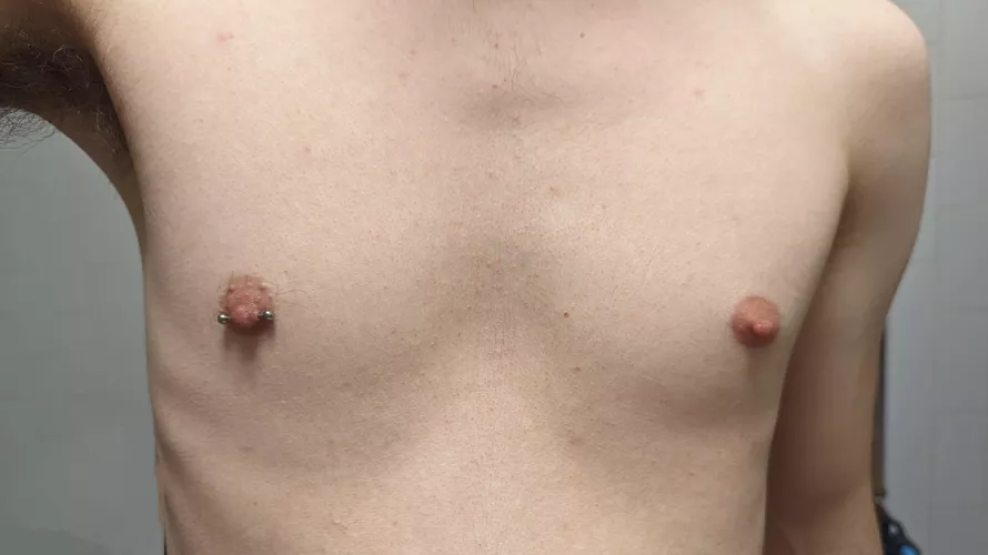 Missing my nipple piercing, should I get them both done?