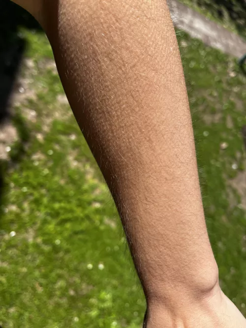 My shiny hairy [arms]