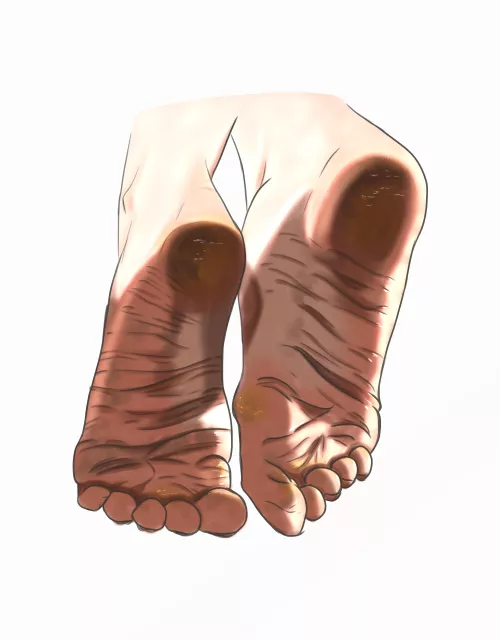 Rough feet 