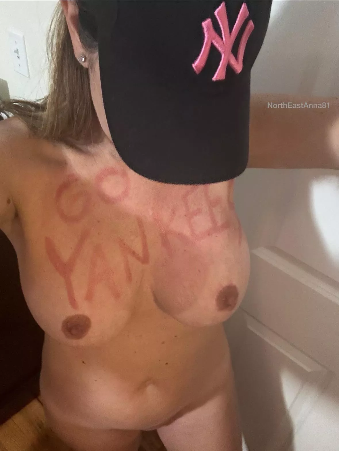 Sending good vibes…. Go Yankees !!!