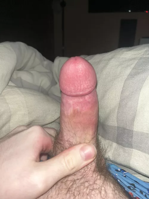 (18) dms open