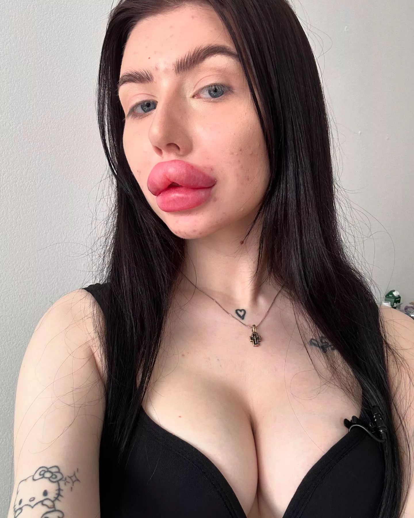 huge lips