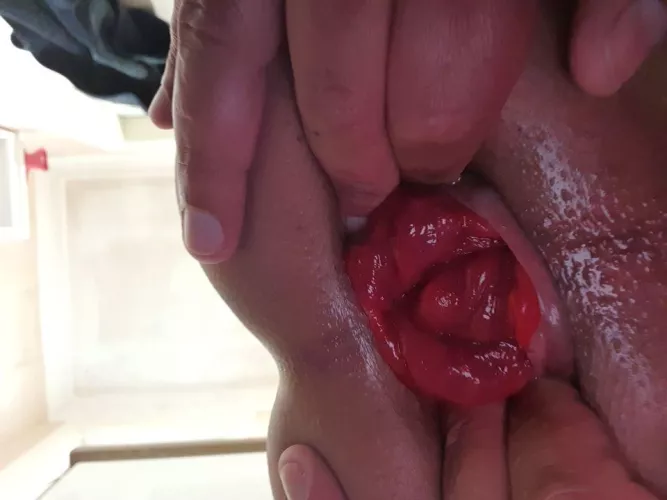 Need help to get it out. Any advice 