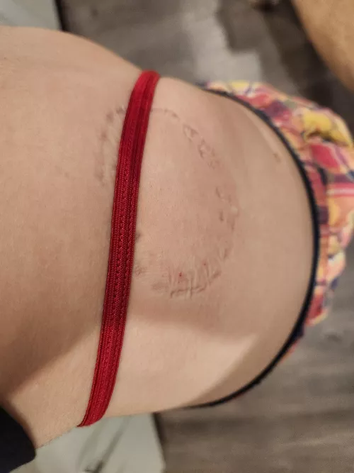 Puppy got bitten >.<