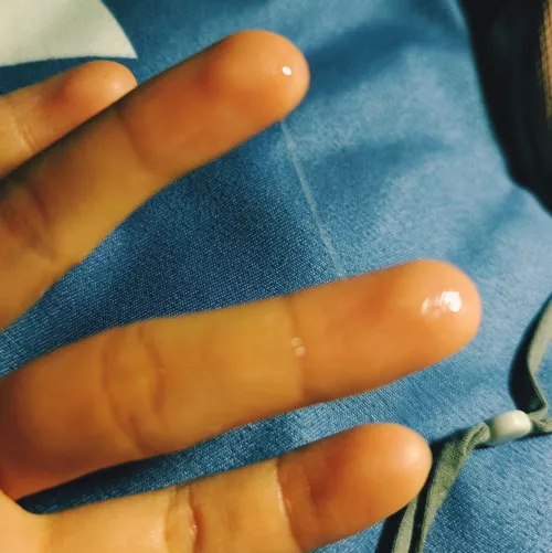 Sometimes my 10 month vegan kitty gets wet