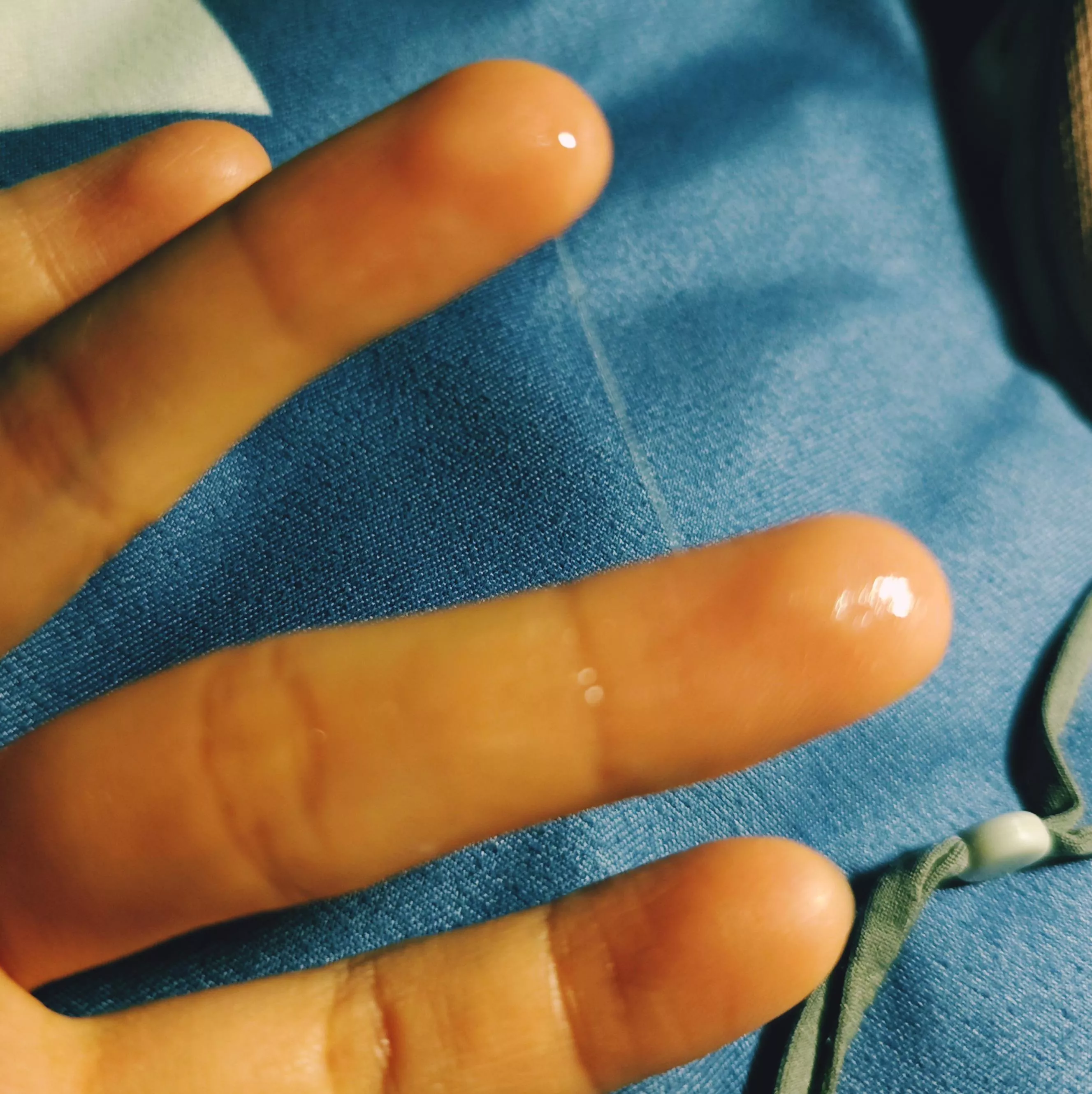 Sometimes my 10 month vegan kitty gets wet