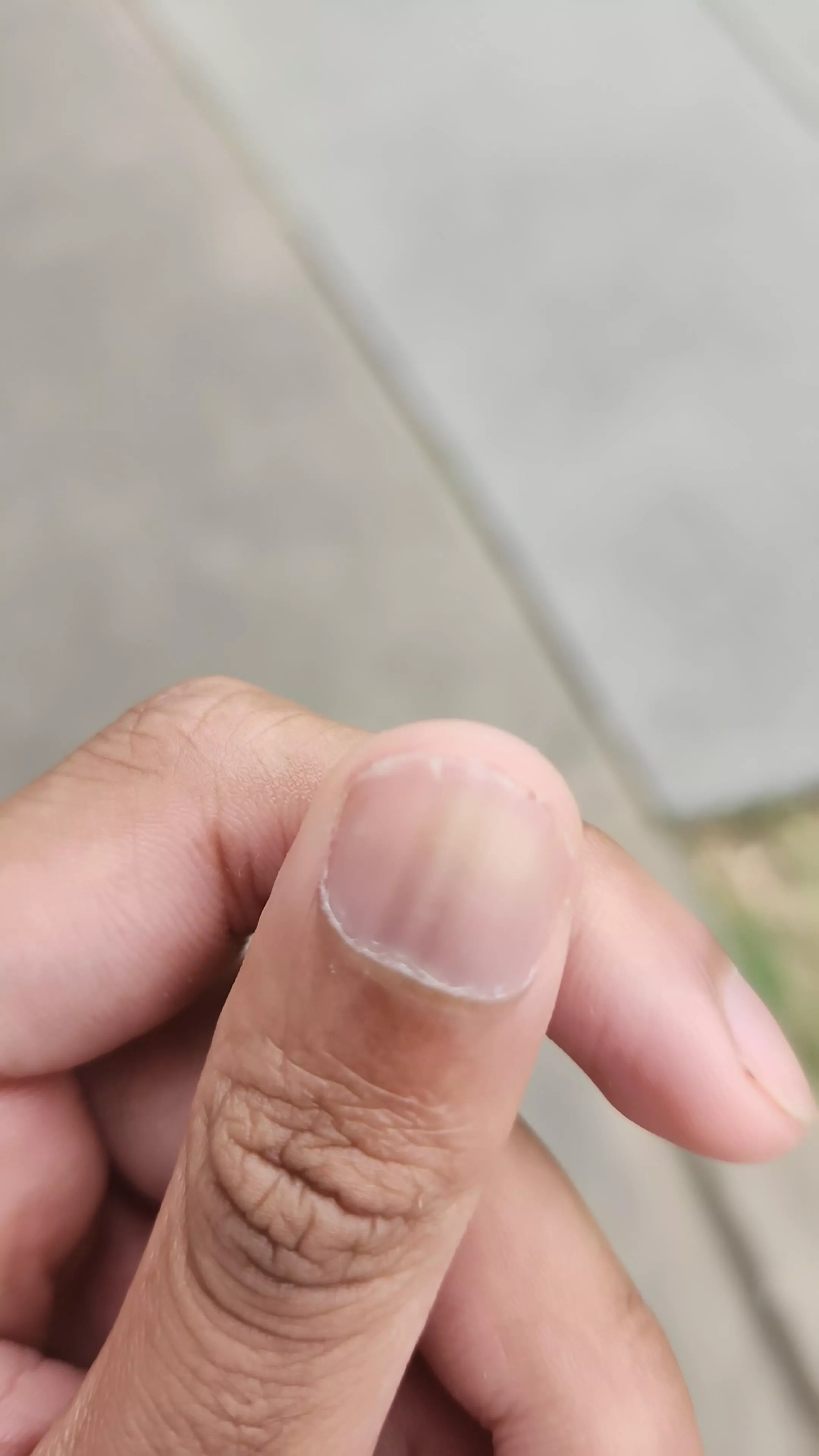 What is this on my nail? Please help 