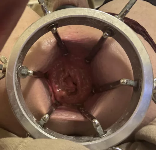 Wide open needs to be filled 