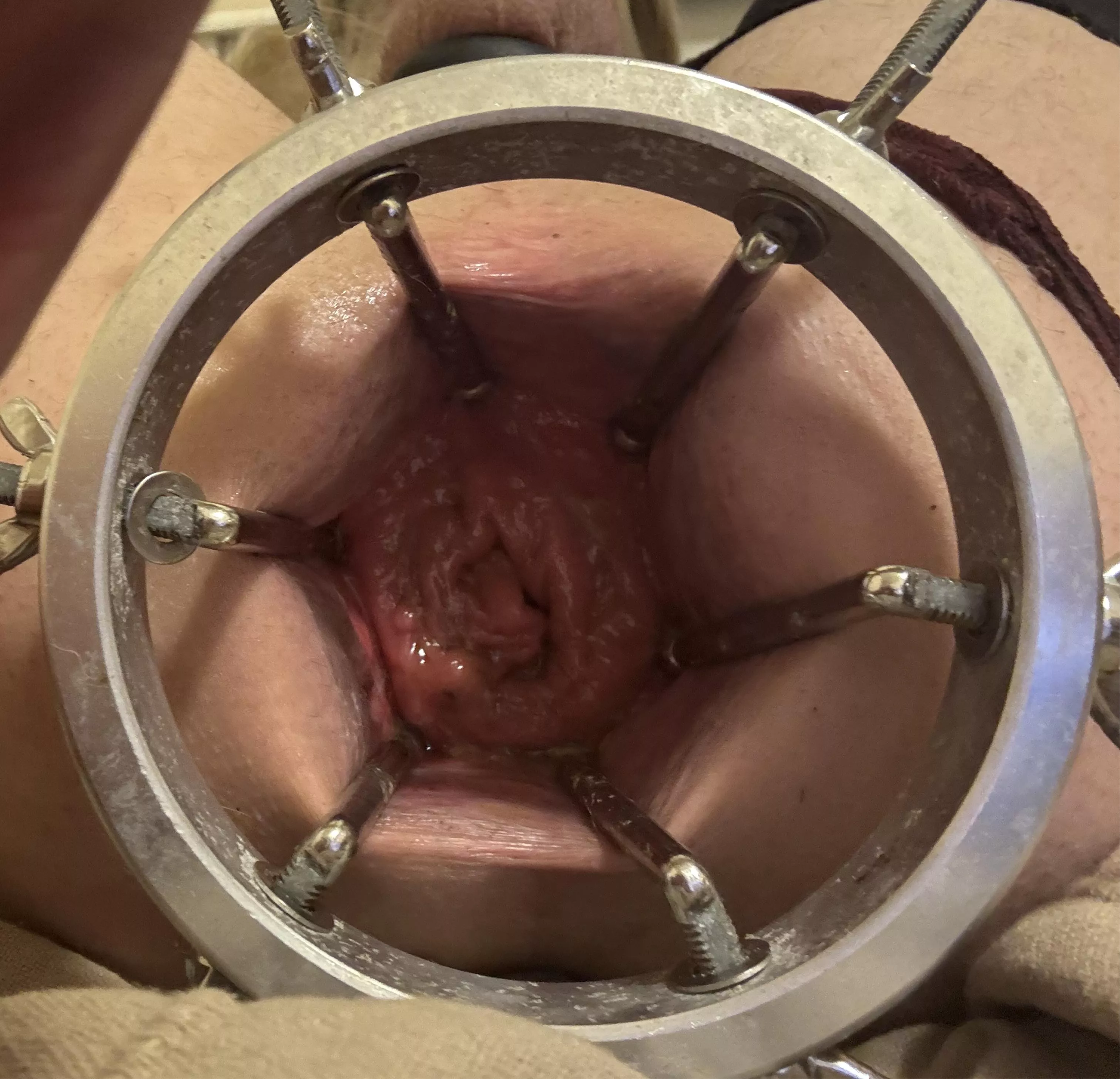 Wide open needs to be filled 