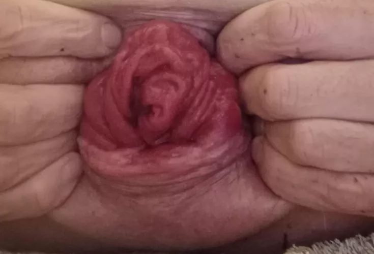 Working on my prolapse 