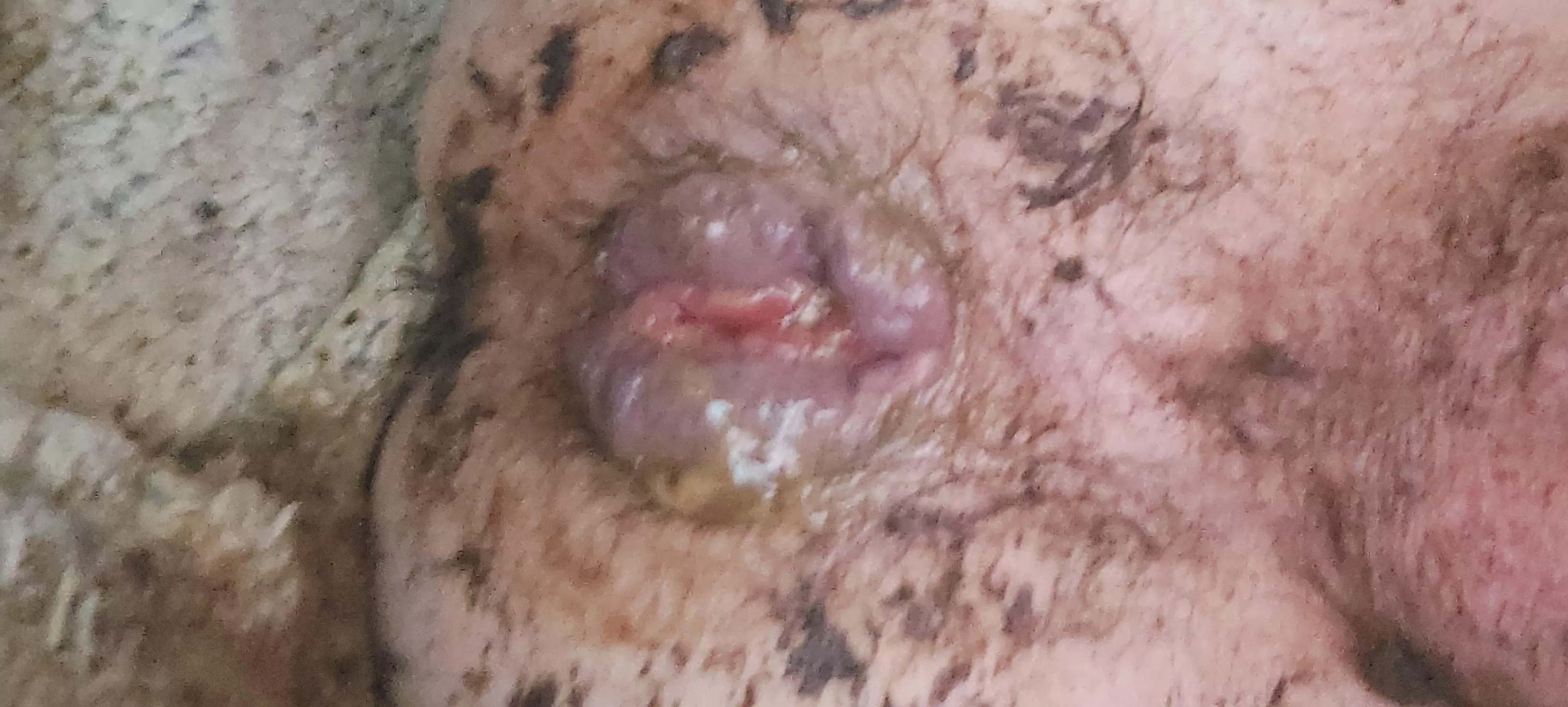 Love my shitty bussy 