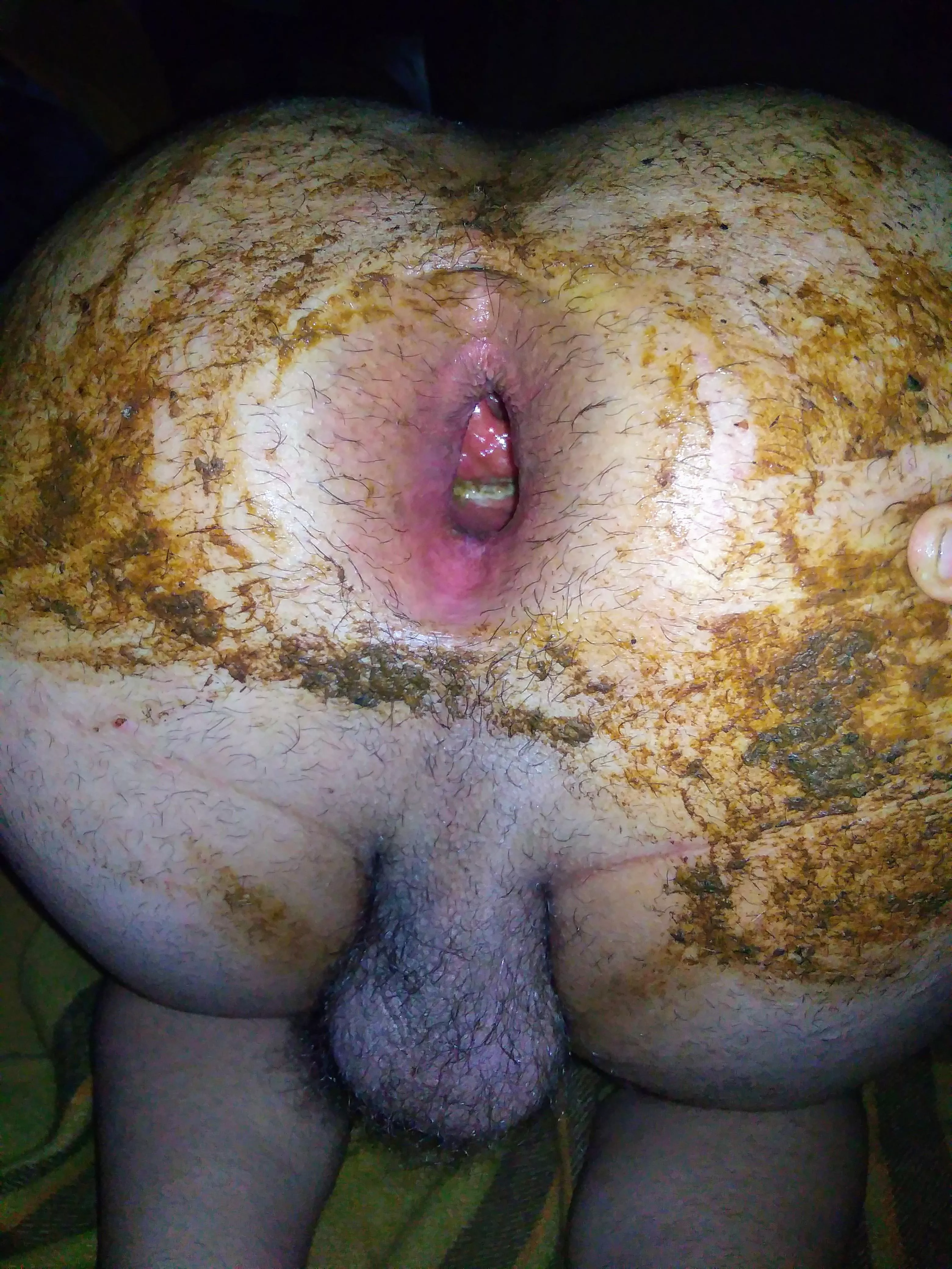 My dirty anal gape