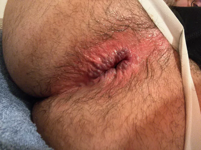 First timer, couldn’t get past the knuckles. Any tips? 